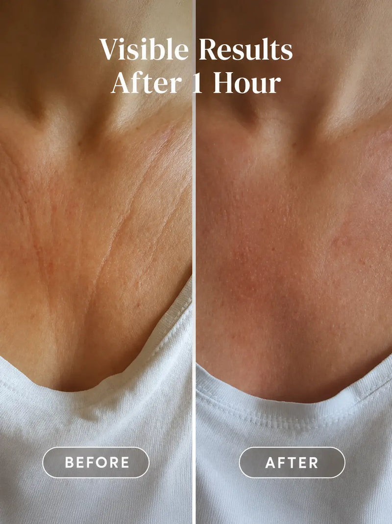 Apricot Beauty Décolleté Pad Hyaluron