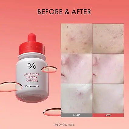 Dr.Ceuracle Azelaic 10 & Madeca Ampoule