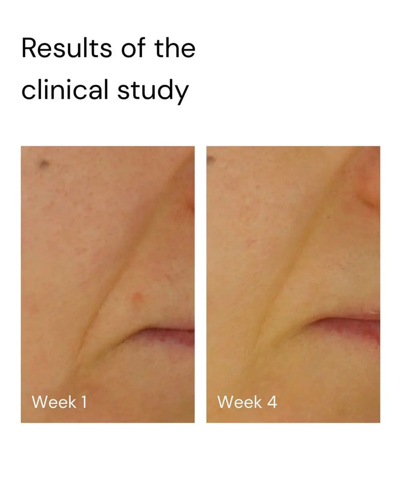 Merme Berlin Super Stable C Face Serum 30 ml.