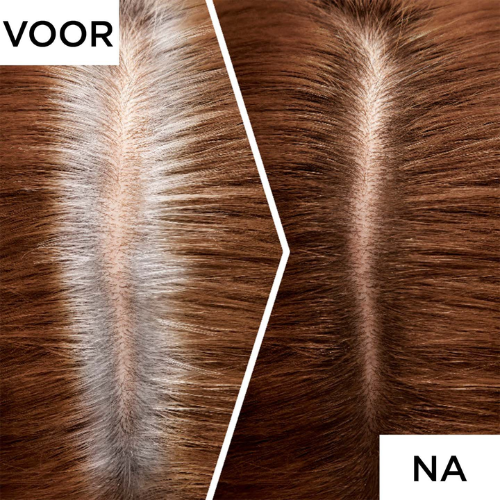 L'Oréal Paris Magic Retouch Midden bruin