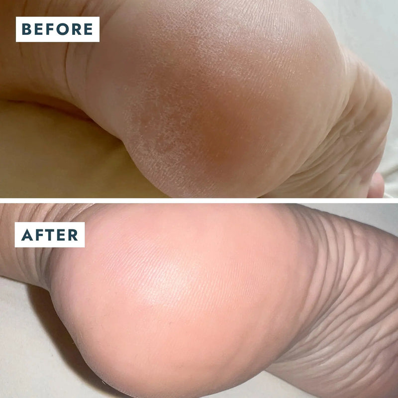 Voesh SoleMate Heel Repair Balm